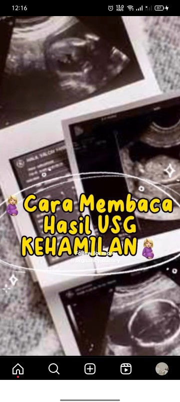 Sharing: Cara Baca Hasil USG