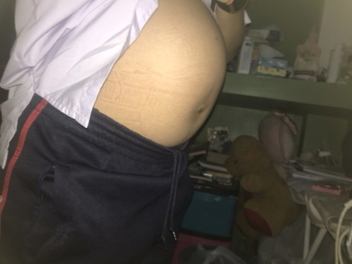 ทำไมท้องถึงเป็นแบบนี้ แม่ๆบ้านไหนทราบบ้างคะ 32+3