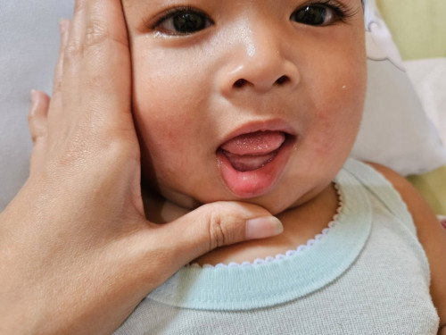 Badan agak anget, apakah tumgi?