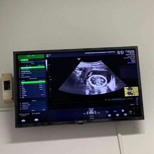 แม่ๆว่า ผญ รึ ผช ค่ะ ดูไม่ออกเลยดูไม่เป๋นด้วยค่ะ