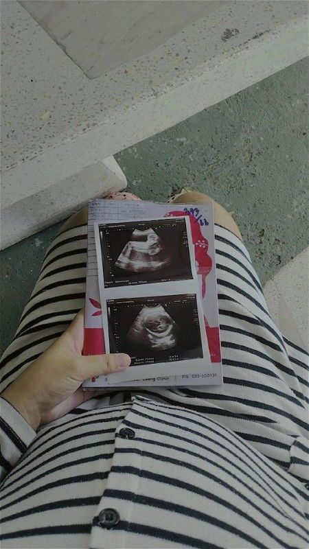 มาอัพเดตน้ำหนักสาวน้อย32weeksค่ะ