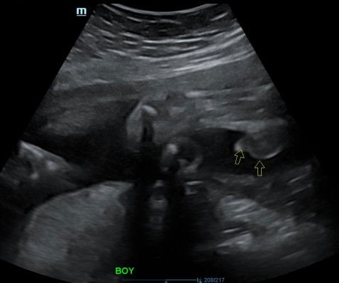 Confirm ke boy sbb da bnyk beli bju boy🤣