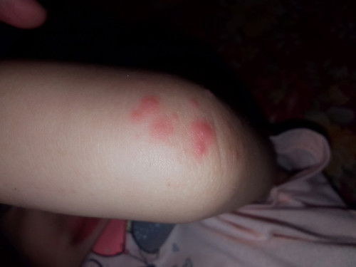 ANO PO KAYA ETONG TUMUTUBO SAAKING ANAK