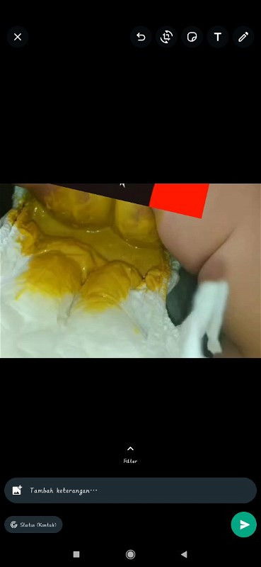 yg jijik boleh skip ya bun..