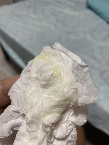Mucus Plug?