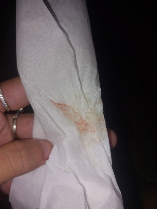 36 week lendir darah