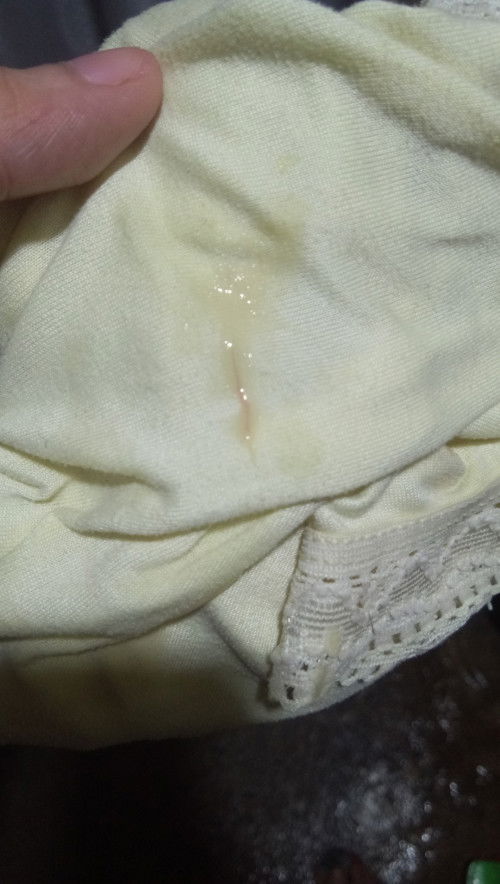 Ask lang po discharge na po ba ito?