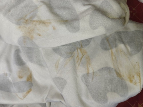 Brown discharge