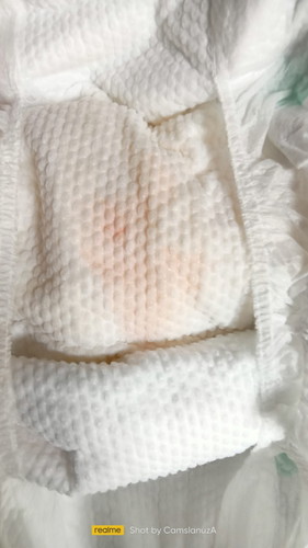 Pano po kumukuha ng urine sample ni baby 3 months old Po si lo salamat po my orange stain po kasi.❤️