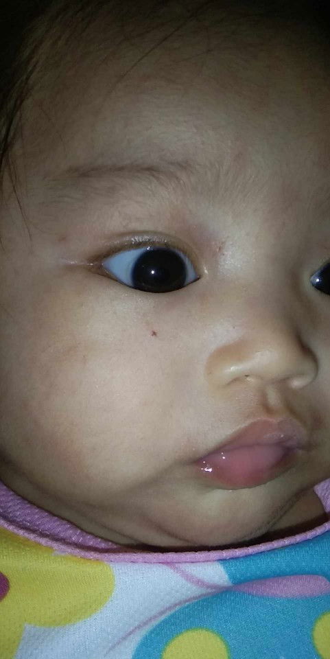 Normal lang po ba ito sa 3months old?