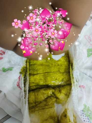 Najis hijau