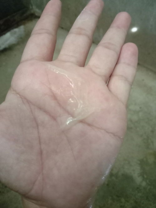 37+4week แบบนี้เรียกมูกไหมค่ะ