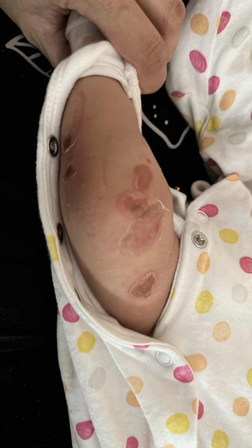 Ada pernah kena dekat bayi anda?