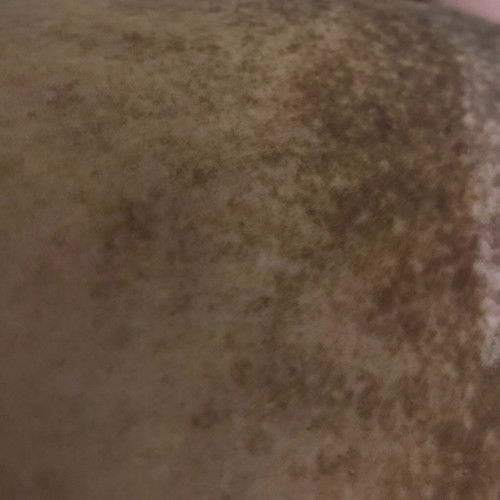 Ada yg sama atau ada yg pernah ngalamin?