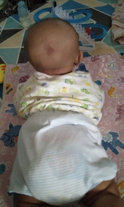 belakang kepala ada tanda me merah