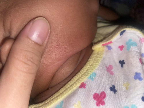 Hai nak tnya ni ruam ka? Cream ap yg bagus