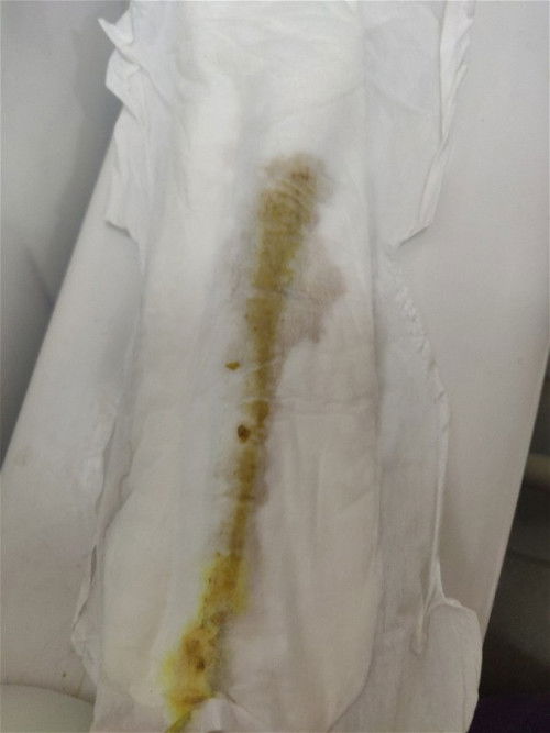 Berpantang Hari ke 11