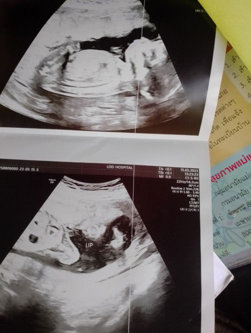 อยากถามแม่ๆหน่อยคะว่าลุกเป็นผู้หญิงหรือชายคะ