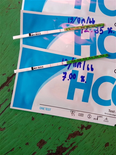 การตรวจครรภ์