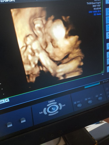 มาเเล้วคับลูกชายน้อยคนเเรกของเเม่
