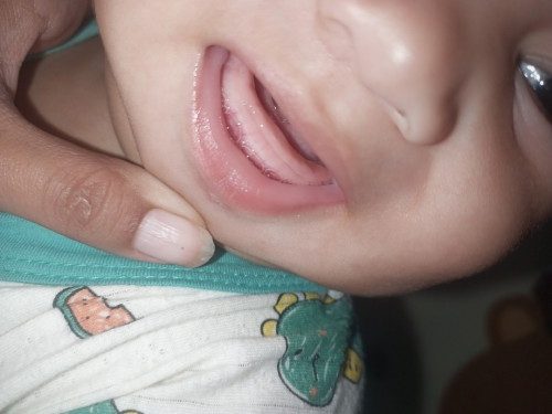 Teething Stage