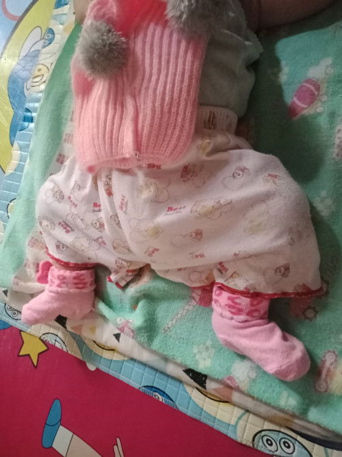 Bayi tidur kakinya ngangkang