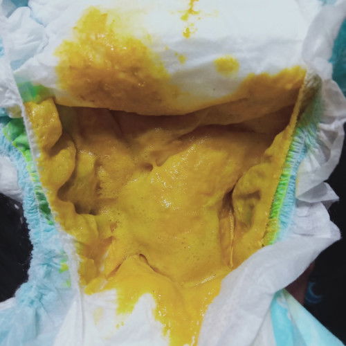 May bula ang tae ni baby