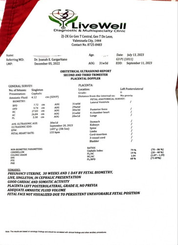 NORMAL LANG PO BA RESULT