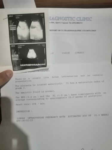 Hi mga moms ano po BPD (HC) ng baby niyo nun 15wks ultrasound niyo? Ako kc 2.4cm normal lng ba yun?