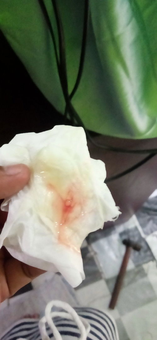 Keluar lendir dara usia 38w