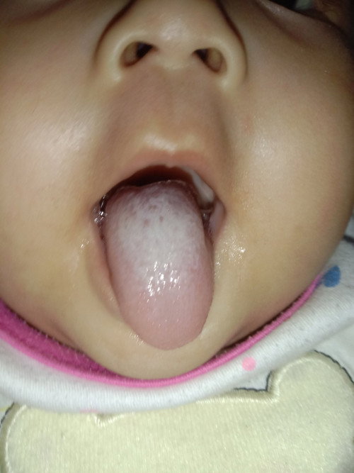 Jamur atau bukan?