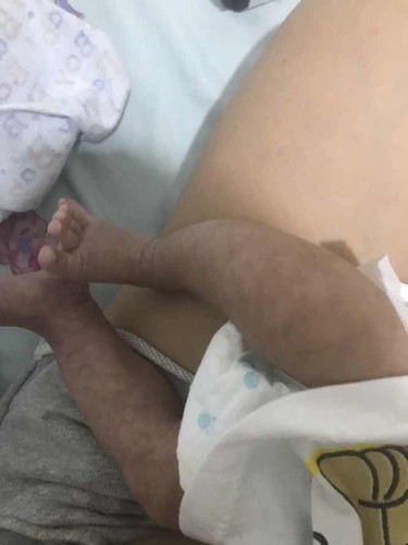 Is this natural skin for 2 month old baby ?