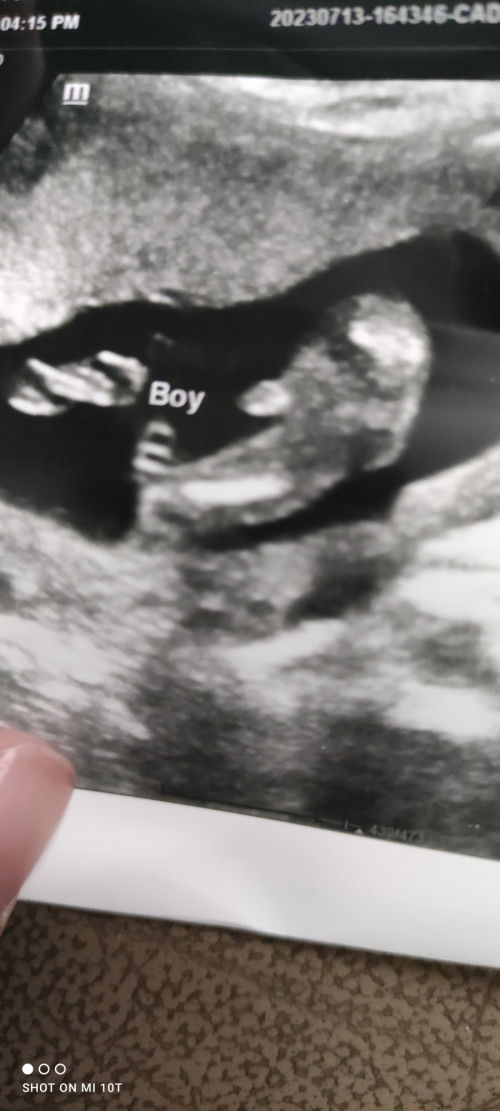 16 week boleh nampak gender