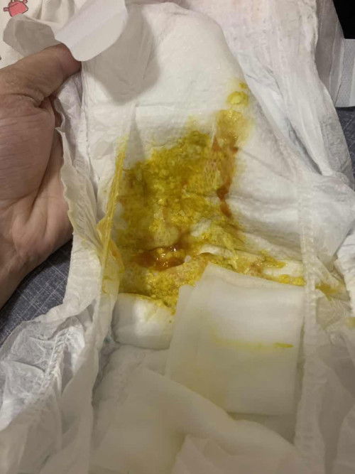 I need your advices mga mi.