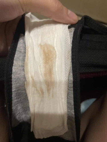 Implantation bleeding kaya ito?