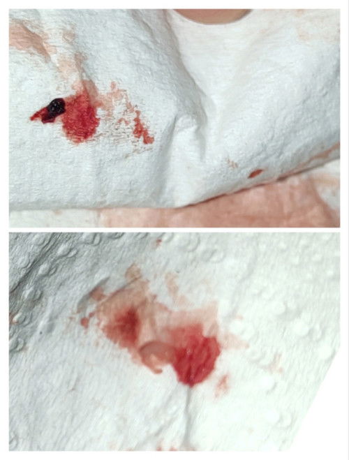 Mucus plug na po ba to?