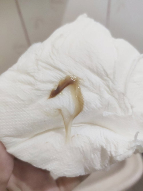 Not sure if mucus plug nga ba or not