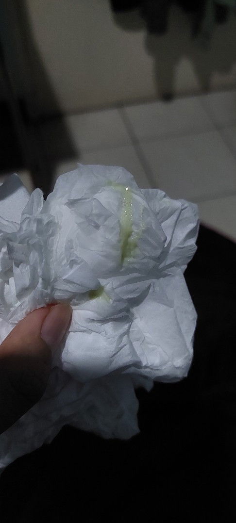 Keputihan hijau lagi setelah 2 minggu membaik