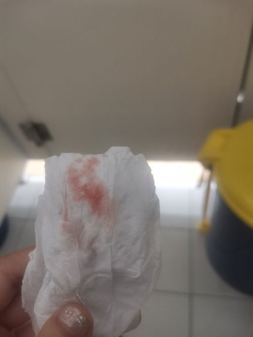 เเท้งคุกคาม