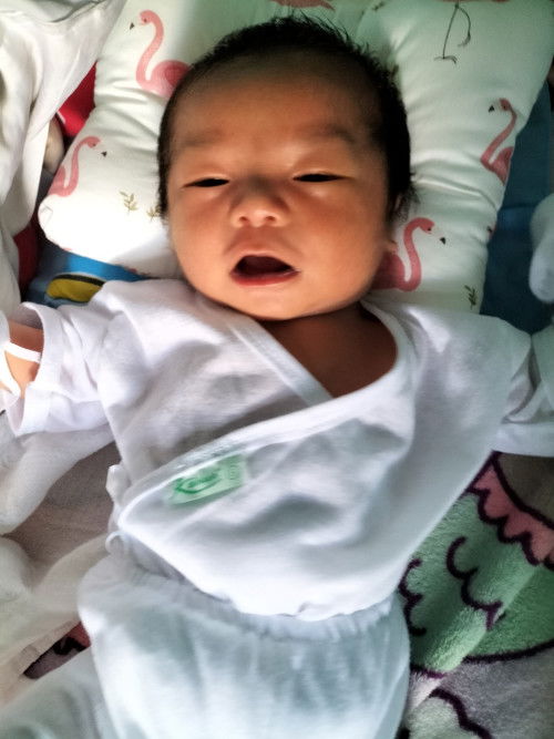 normal lng po na maitim labi ng baby ko ??3weeks na po sya.,ok nmn po result ng new born screening