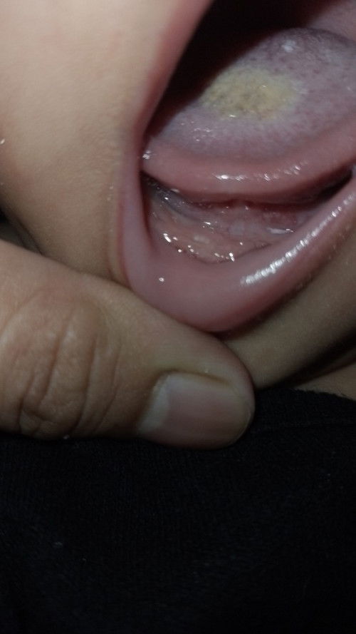 Nagngingipin na po ba ito?