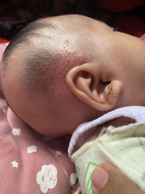 Bayi umur 2 bulan 6 hari