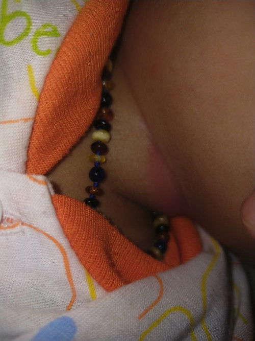 Lipatan ketiak memerah juga leher