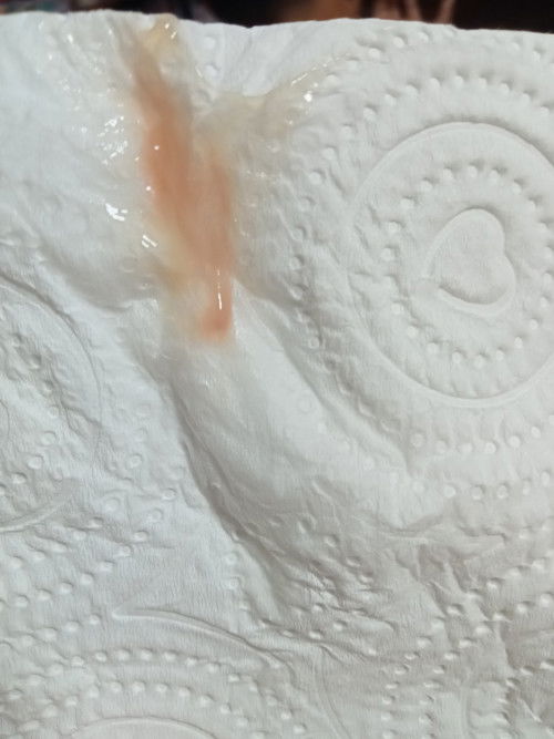 38+2 มีมูกใสๆป่นเลือดออกตอนสามทุ่มครึ่งเมื่อคืน