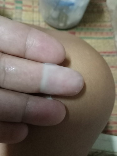 ตกขาวหรืออะไร