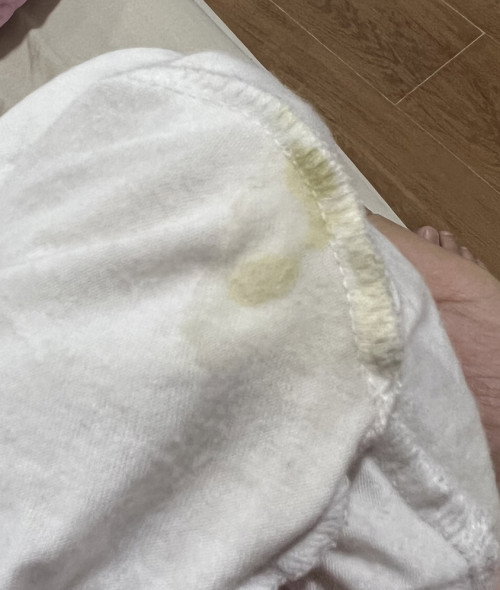 Keluar tanda putih kuning di seluar..