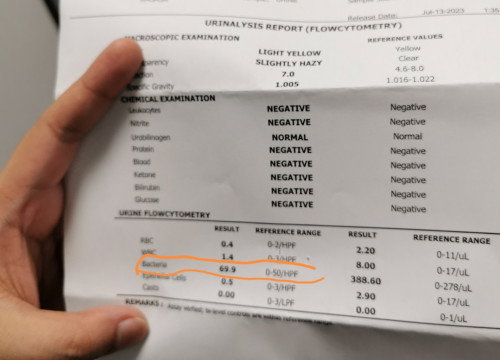 Urinalysis result