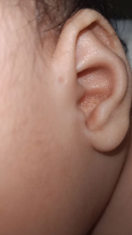 Please help po. Ear wax? Skin?