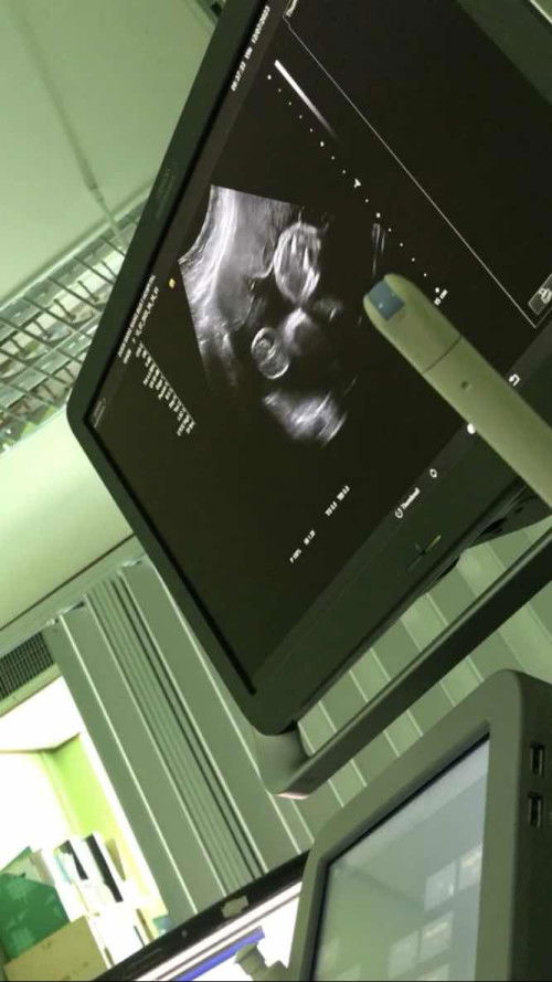 ทีมสิงหา #ขอบคุนสำหรับคำตอบนะคะ