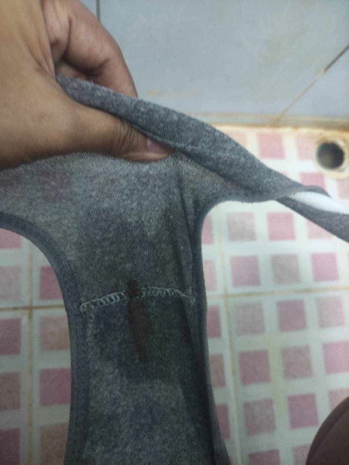 เลือดออกตั้งครรภ์